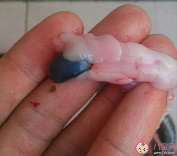 胎盤成熟早容易早產嗎  胎盤早熟還能補鈣嗎