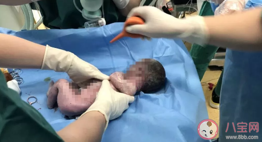 孕媽媽生產(chǎn)是助產(chǎn)士接生嗎  孕婦生產(chǎn)什么情況是醫(yī)生接生