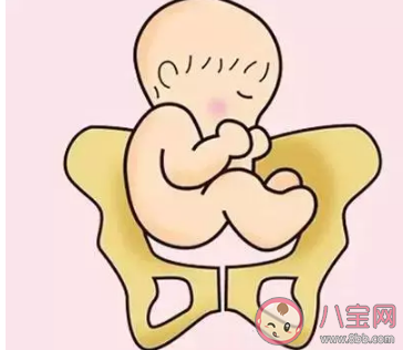 胎位不正臀位怎么辦 胎位不正臀位怎么調(diào)整過來 胎位不正臀位怎么辦 胎位不正臀位怎么調(diào)整過來