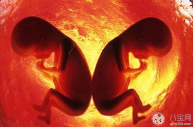 雙胞胎在母體內(nèi)會(huì)打架嗎 雙胞胎是怎么形成的 雙胞胎在母體內(nèi)會(huì)打架嗎 雙胞胎是怎么形成的