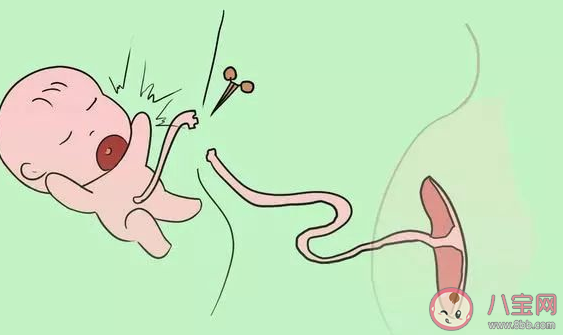 剪臍帶時寶寶會疼嗎 剪臍帶寶寶為什么會大哭 剪臍帶時寶寶會疼嗎 剪臍帶寶寶為什么會大哭