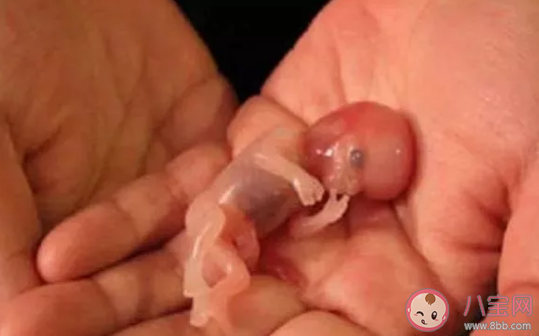 打過胎的女孩能看出來嗎 打胎和沒打胎的女孩有什么區別 打過胎的女孩能看出來嗎 打胎和沒打胎的女孩有什么區別