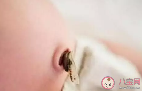 新生兒肚臍多長時間能痊愈  臍帶未脫落前能給寶寶穿紙尿褲嗎