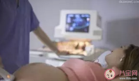 胎盤成熟慢會推遲生嗎  胎盤成熟慢是缺鈣嗎