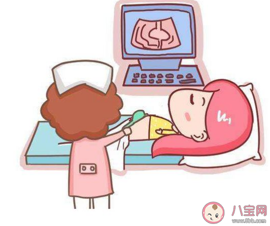 自己買胎心儀每天監測胎心好不好  胎心監測儀自己要買嗎