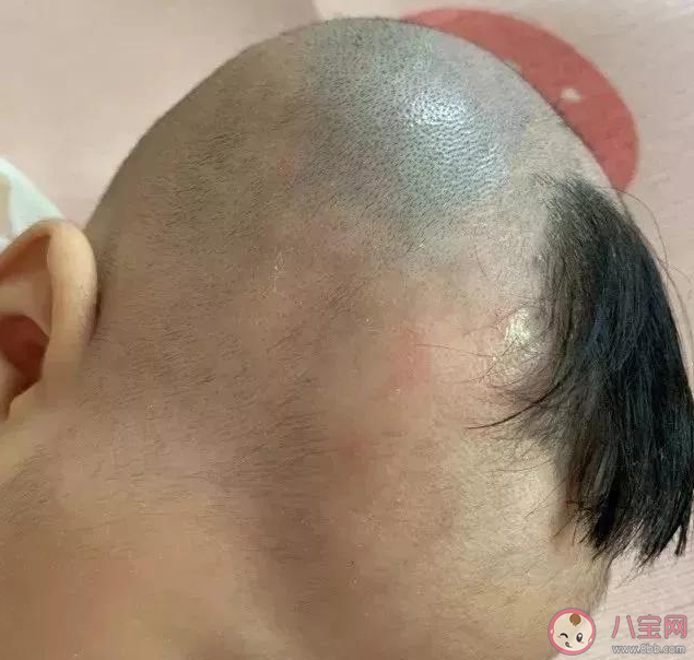 夏天給寶寶剃光頭有什么危害 如何給孩子剪一個(gè)既涼快又安全的發(fā)型 夏天給寶寶剃光頭有什么危害 如何給孩子剪一個(gè)既涼快又安全的發(fā)型