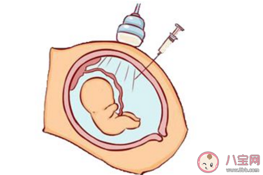 高齡孕婦不想做羊穿怎么辦  哪些人不適合羊水穿刺