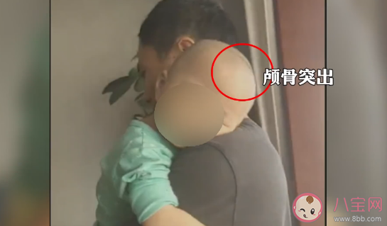 大頭娃娃是由于什么原因造成的  怎樣辨別嬰兒是大頭