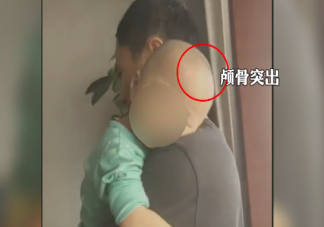 大頭娃娃是由于什么原因造成的  怎樣辨別嬰兒是大頭