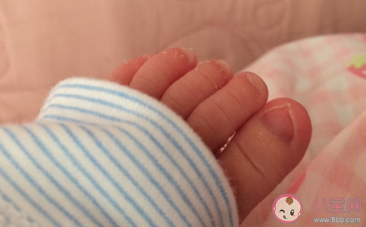 為什么寶寶生下來身上有好多白色的 寶寶身上的胎脂可以自己吸收嗎