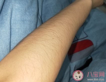 女生汗毛太多的煩惱 女生汗毛太多怎么辦