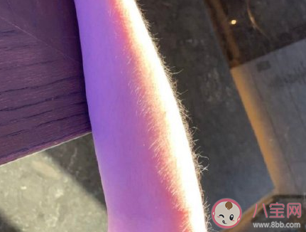 女生汗毛太多的煩惱 女生汗毛太多怎么辦