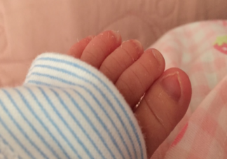 為什么寶寶生下來身上有好多白色的 寶寶身上的胎脂可以自己吸收嗎