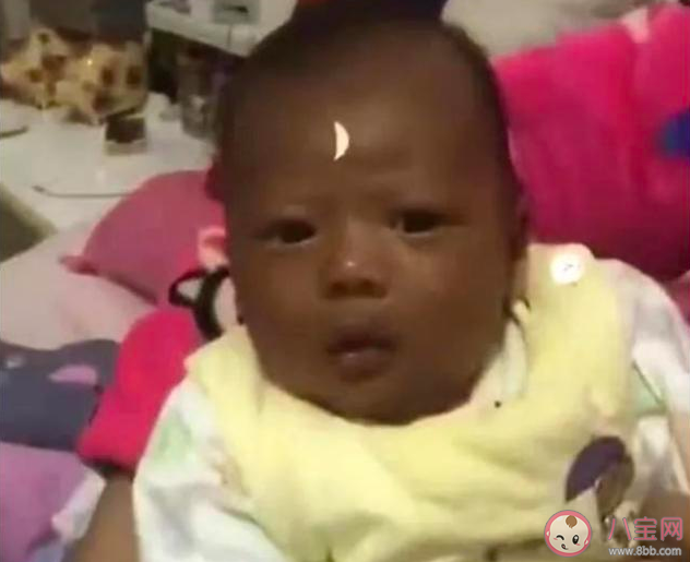 懷孕了吃什么食物能讓孩子皮膚白 寶寶的膚色和懷孕的飲食有關嗎 懷孕了吃什么食物能讓孩子皮膚白 寶寶的膚色和懷孕的飲食有關嗎