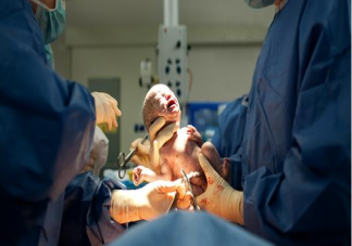 剖腹產(chǎn)前必須禁食嗎 剖腹產(chǎn)前需要禁食多久