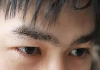 眼皮浮腫是怎么回事 眼皮浮腫和什么有關(guān)