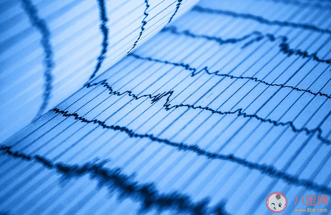 做心電圖心律不齊嚴(yán)重嗎 出現(xiàn)心律不齊要注意什么 做心電圖心律不齊嚴(yán)重嗎 出現(xiàn)心律不齊要注意什么