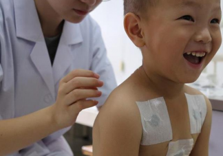 2020三伏貼幾月份開始貼 孩子貼三伏天皮膚過敏灼傷是怎么回事