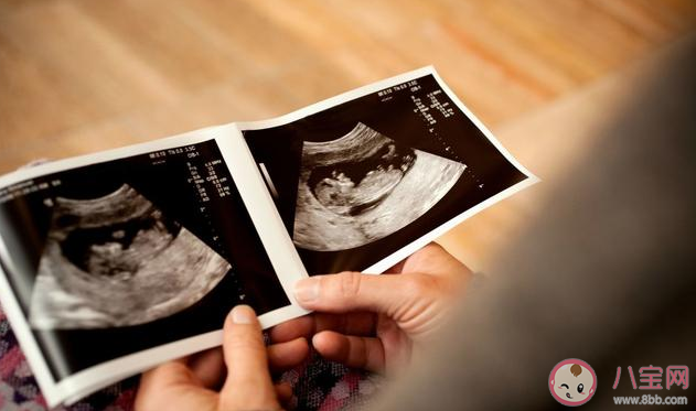 懷孕早期應該做陰超還是腹超 孕早期做陰道B超會不會影響胎兒 懷孕早期應該做陰超還是腹超 孕早期做陰道B超會不會影響胎兒