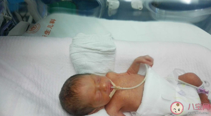 寶寶為什么會得敗血癥 如何預防新生兒敗血癥