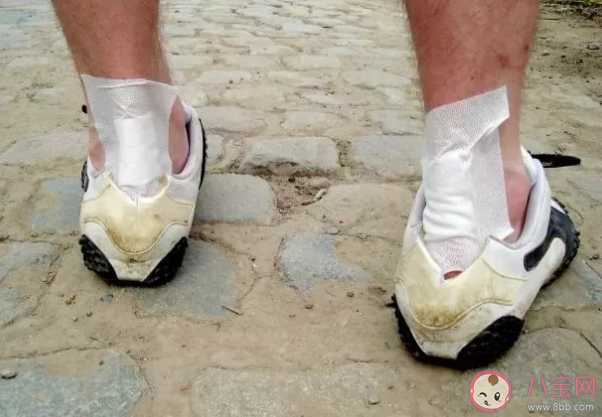 腳后跟疼是什么原因導致的 腳后跟疼怎么治療 腳后跟疼是什么原因導致的 腳后跟疼怎么治療