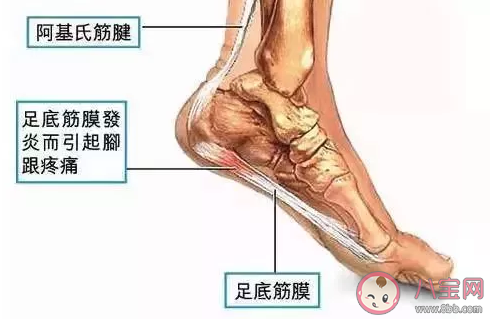 腳后跟疼是什么原因導致的 腳后跟疼怎么治療 腳后跟疼是什么原因導致的 腳后跟疼怎么治療