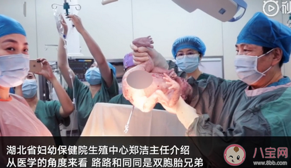 相差十歲雙胞胎什么意思 為什么雙胞胎兄弟相差10歲 相差十歲雙胞胎什么意思 為什么雙胞胎兄弟相差10歲