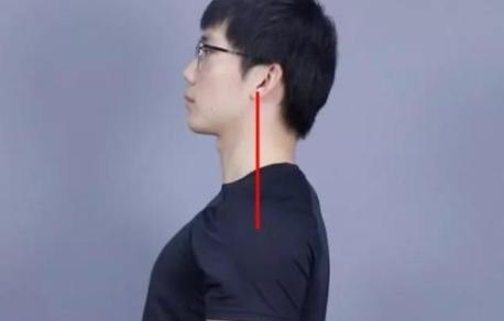 女性怎么改善圓肩駝背 改善圓肩駝背的幾個動作 女性怎么改善圓肩駝背 改善圓肩駝背的幾個動作