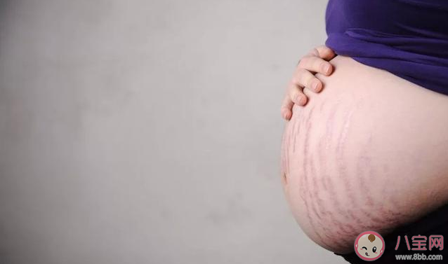 孕期肚子小不會長妊娠紋嗎 妊娠紋和肚子大小有關嗎 孕期肚子小不會長妊娠紋嗎 妊娠紋和肚子大小有關嗎