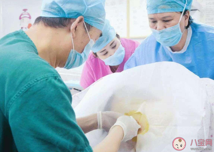 順產(chǎn)打無痛針后遺癥是什么 無痛分娩針在什么時(shí)候打