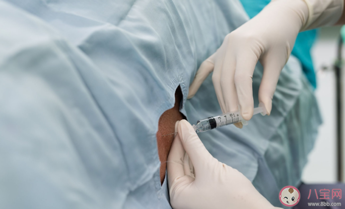 順產(chǎn)打無痛針后遺癥是什么 無痛分娩針在什么時(shí)候打