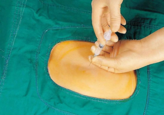 順產打無痛針后遺癥是什么 無痛分娩針在什么時候打