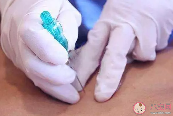 埋線減肥過程中有副作用嗎 埋線減肥后有哪些注意事項 埋線減肥過程中有副作用嗎 埋線減肥后有哪些注意事項