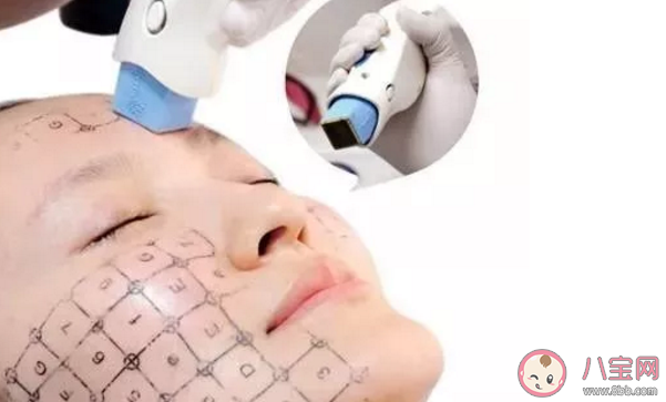 熱瑪吉做一次可以保持多久 熱瑪吉能維持多長時間