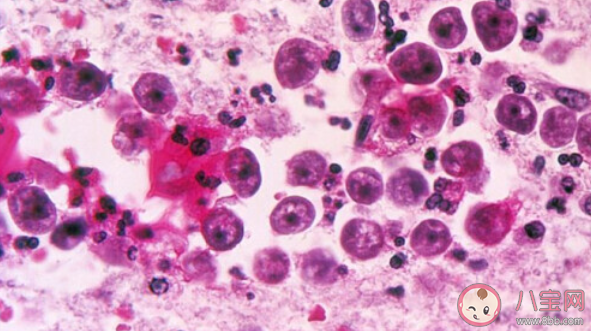 食腦蟲有多可怕 食腦蟲致死率有多高