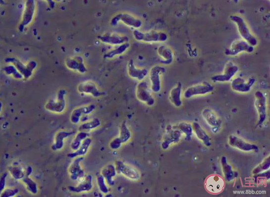 食腦蟲有多可怕 食腦蟲致死率有多高