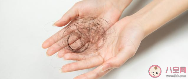 為什么生完孩子脫發嚴重 產后脫發現象會持續多久 為什么生完孩子脫發嚴重 產后脫發現象會持續多久