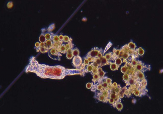 食腦蟲是什么 食腦蟲生長在什么地方