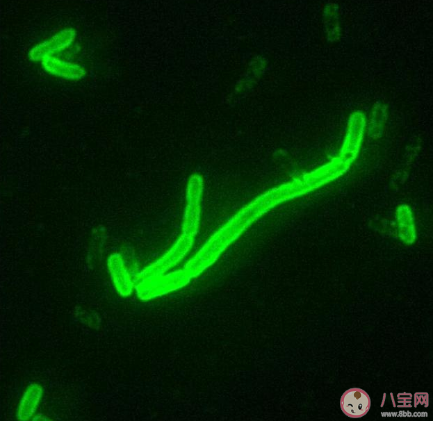 得了鼠疫有哪些癥狀 怎么做好鼠疫個人防護