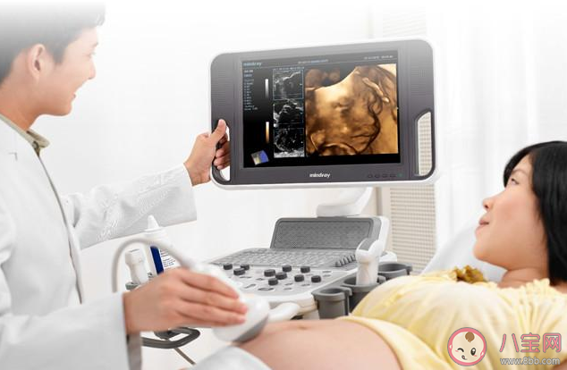 準媽媽被寶寶四維彩超丑哭是怎么回事 胎兒四維照為什么巨丑無比