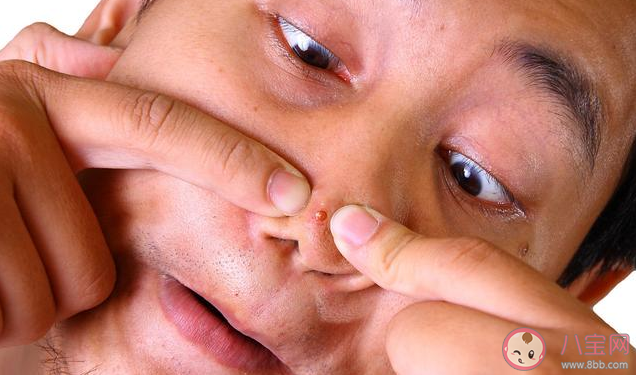 面部危險三角區的痘痘不能擠嗎 面部危險三角區危險在哪里