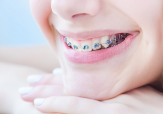 戴牙套期間吃什么食物最好 戴牙套后怎么吃