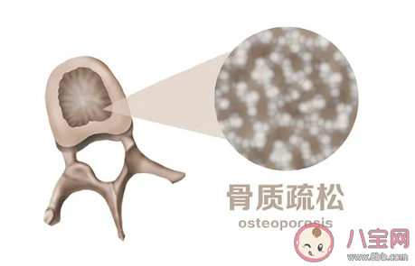 晨起后發現手指僵硬怎么回事 無法握拳是什么原因
