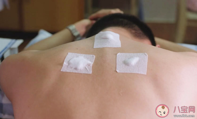 醫院拿回來的三伏天怎么保存 三伏貼中間少貼一次有影響嗎