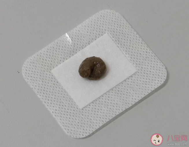 可以網(wǎng)購三伏貼自己貼嗎 網(wǎng)購三伏貼靠譜嗎