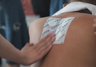 醫(yī)院拿回來的三伏天怎么保存 三伏貼中間少貼一次有影響嗎