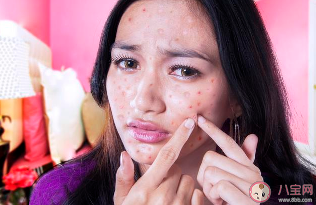 油痘肌的護(hù)膚品該怎么挑 油痘肌的護(hù)膚品挑選攻略指南 油痘肌的護(hù)膚品該怎么挑 油痘肌的護(hù)膚品挑選攻略指南