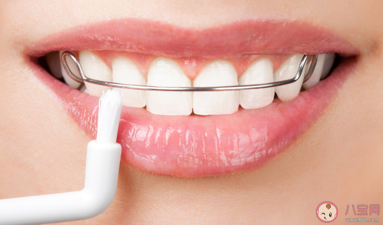 牙齒矯正會有后遺癥嗎 牙齒不及時矯正會有什么后果 牙齒矯正會有后遺癥嗎 牙齒不及時矯正會有什么后果