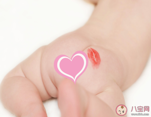 寶寶臀紋不對稱一定是有問題嗎 臀紋不對稱是不是髖關節發育不良