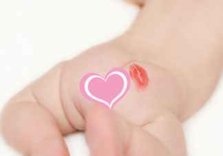 寶寶臀紋不對稱一定是有問題嗎 臀紋不對稱是不是髖關節發育不良